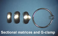 Sectional Matrix Bands and G-clamp